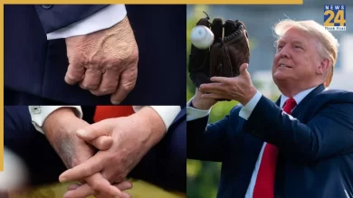 Trump hand bruise makeup: What the White House has said