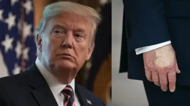 Trump Hand Makeup Health Speculation Sparks Fresh Debate at White House Event