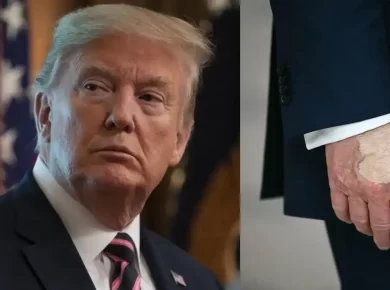 Trump Hand Makeup Health Speculation Sparks Fresh Debate at White House Event