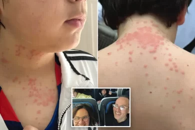 Bedbugs on Flight Lawsuit: Virginia Family Sues Delta and KLM After In-Flight Infestation