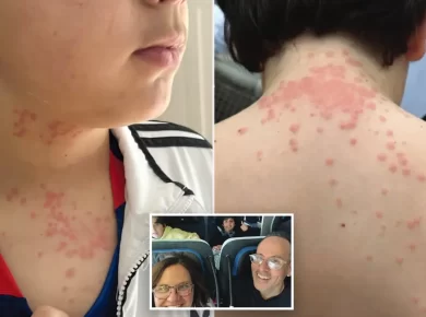 Bedbugs on Flight Lawsuit: Virginia Family Sues Delta and KLM After In-Flight Infestation